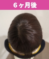 6か月後