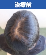 治療前