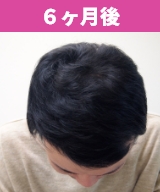 6か月後