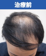 治療前